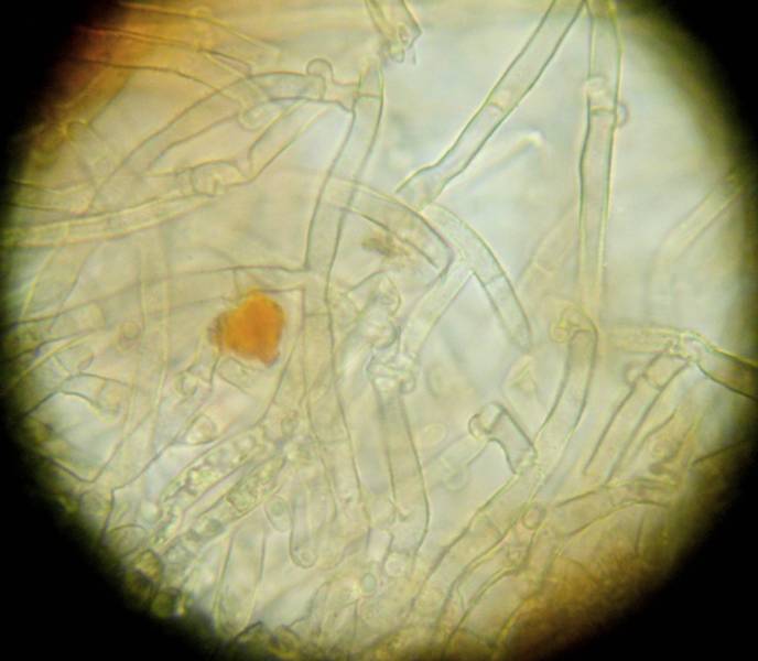 Amphinema byssoides? (Amphinema byssoides)